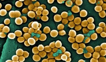 В Европе стремительно распространяется устойчивый к лечению «супергрибок» — рост заражения вырос на 500% за три года